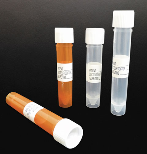 Sample Containers, Polypropylene Urinalysis Specimen Collection Tubes w/ Leakproof Screw Caps